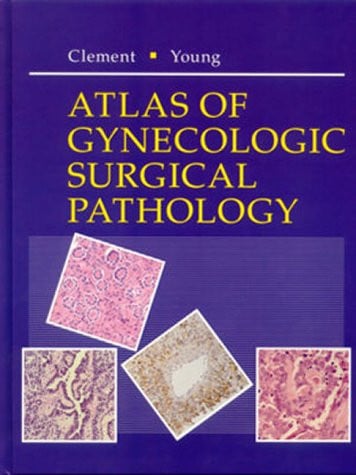 Atlas of Gynecologic Surgical Pathology: A Volume in the Atlases in Diagnostic Surgical Pathology Series (Atlas in Diagnostic Surgical Pathology)
