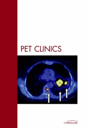 Lung Cancer, An Issue of PET Clinics (Volume 1-4) (The Clinics: Radiology, Volume 1-4)