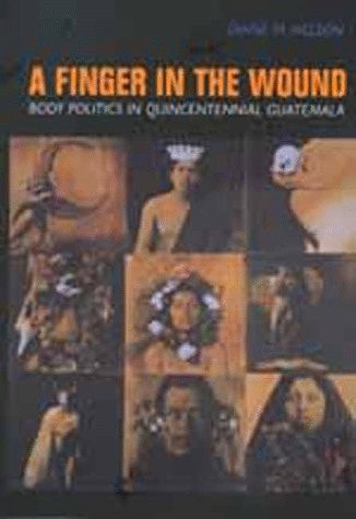 A Finger in the Wound: Body Politics in Quincentennial Guatemala