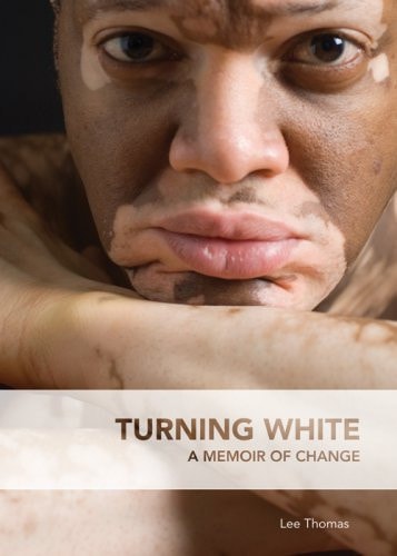 Turning White: A Memoir of Change