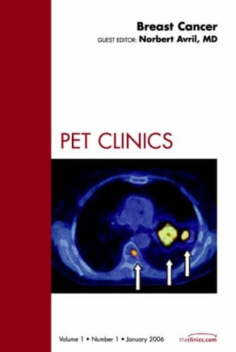 Breast Cancer, An Issue of PET Clinics (Volume 1-1) (The Clinics: Radiology, Volume 1-1)