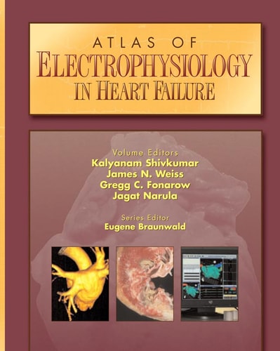 Atlas of Electrophysiology in Heart Failure (Current Medicine)